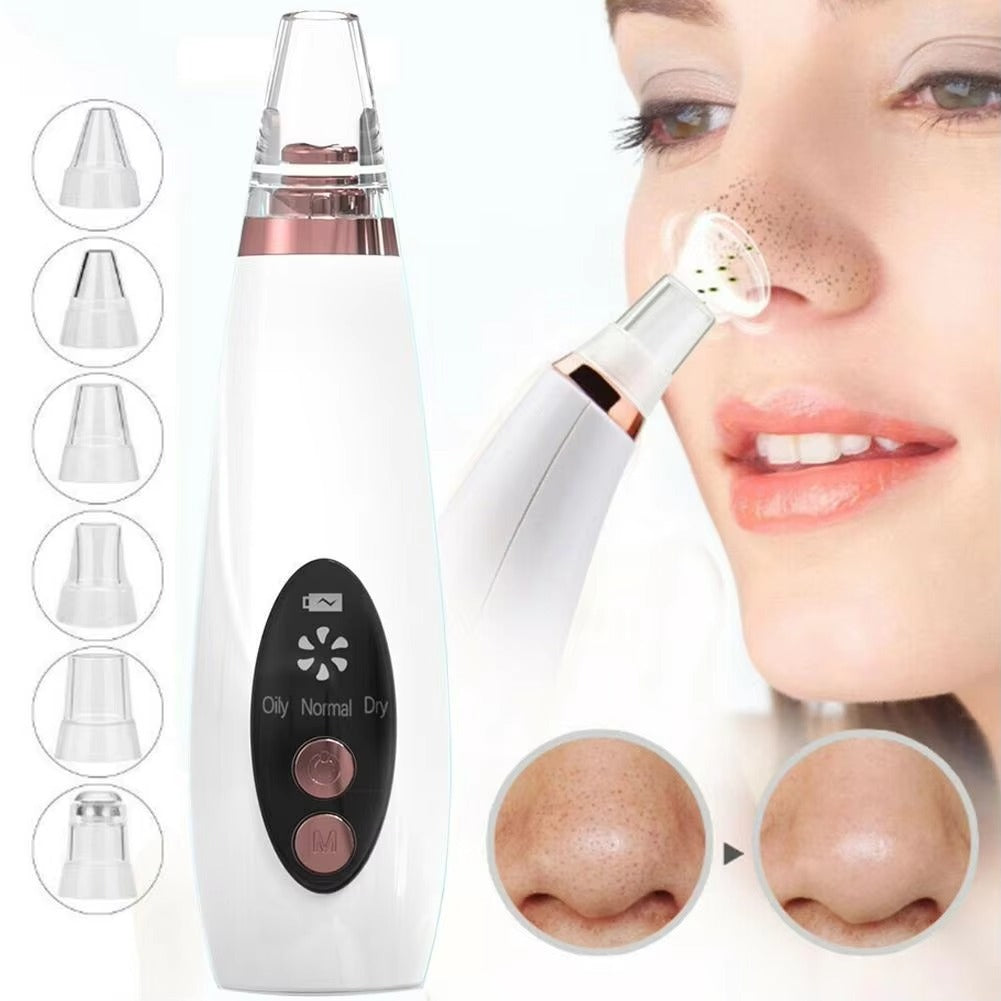 6-in-1 Blackhead Remover Vacuum
